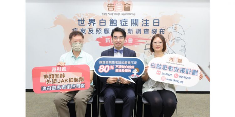 Key Findings from the “Hong Kong Vitiligo Patients and Caregivers Survey” Released for “World Vitiligo Day”
